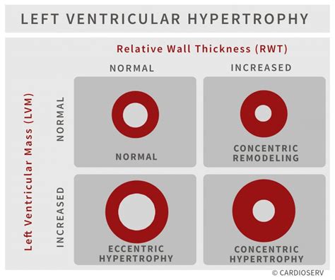 lv walls echo|lvh echo criteria wall thickness.